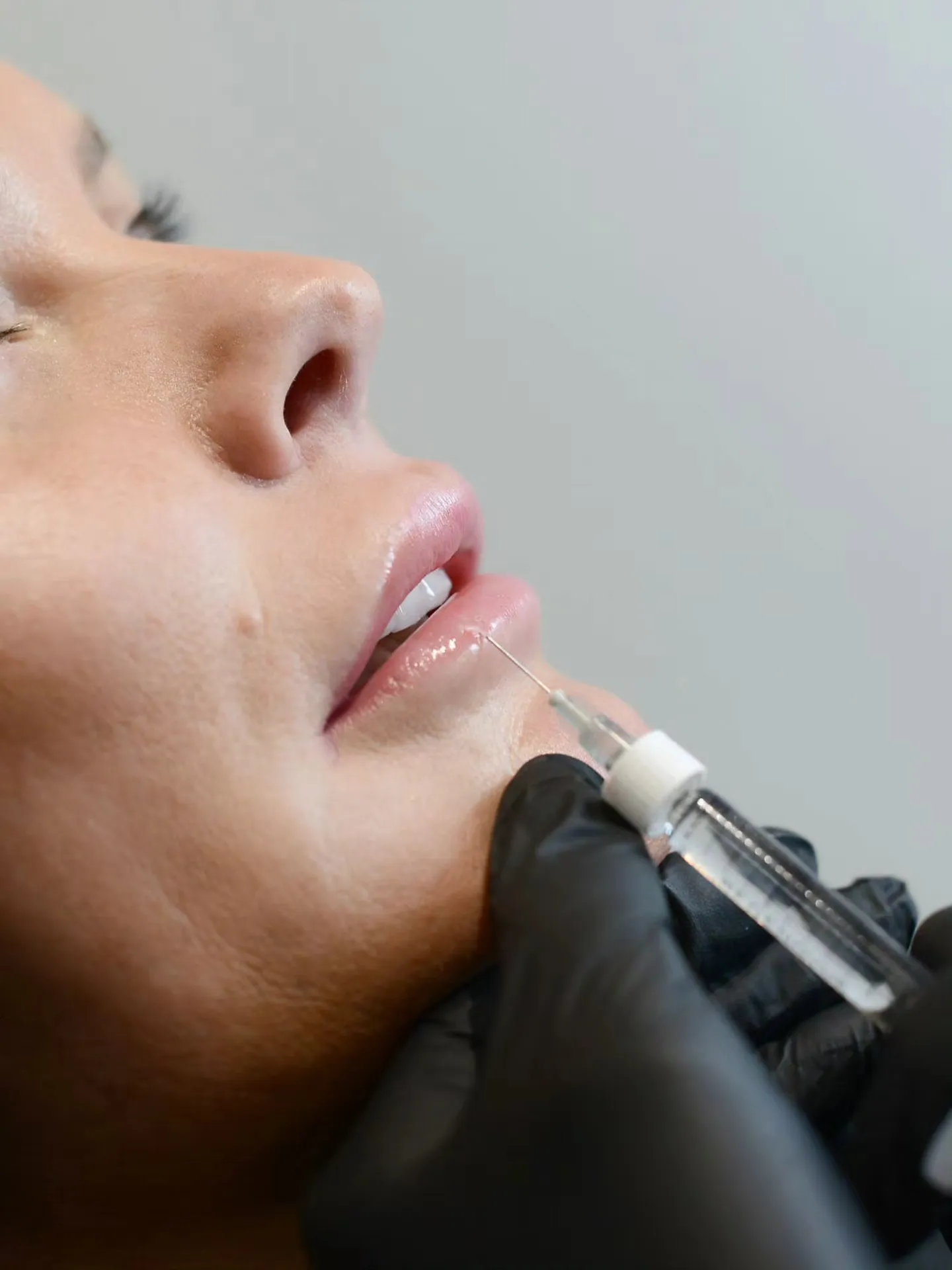 A woman getting botilage treatment from a doctor.